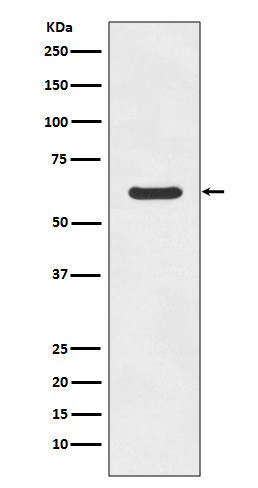 Asparagine Synthetase