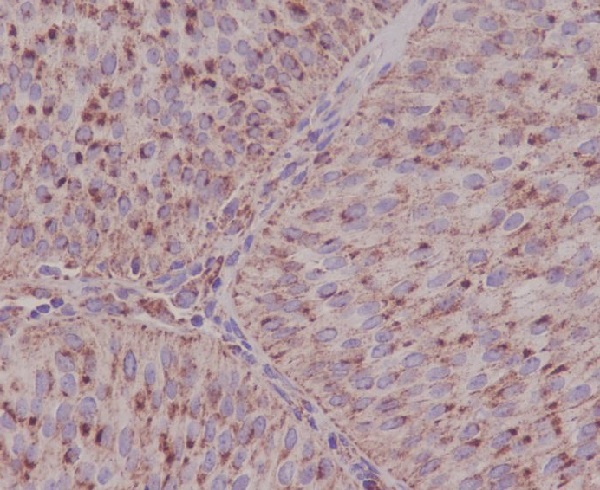 Rabbit Polyclonal Antibody to Asparagine Synthetase