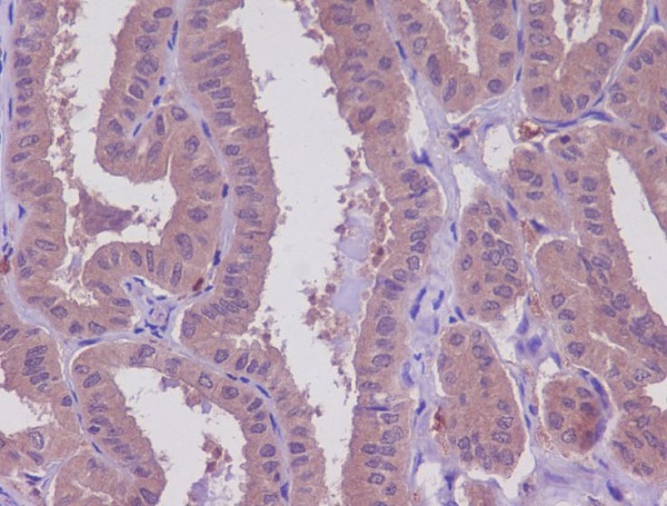 Rabbit Polyclonal Antibody to MEKK2