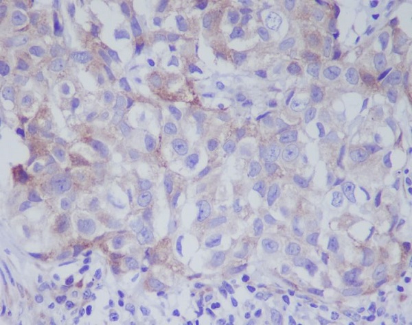 Rabbit Monoclonal Antibody to VAV2 