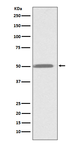 Integrin Linked ILK