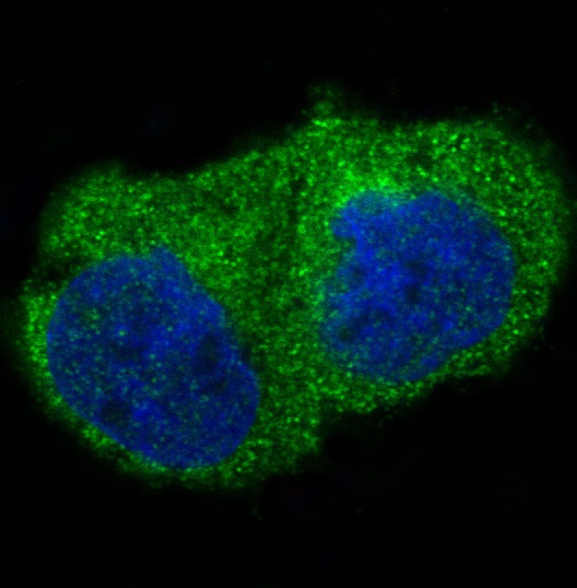 Rabbit Polyclonal Antibody to Integrin Linked ILK