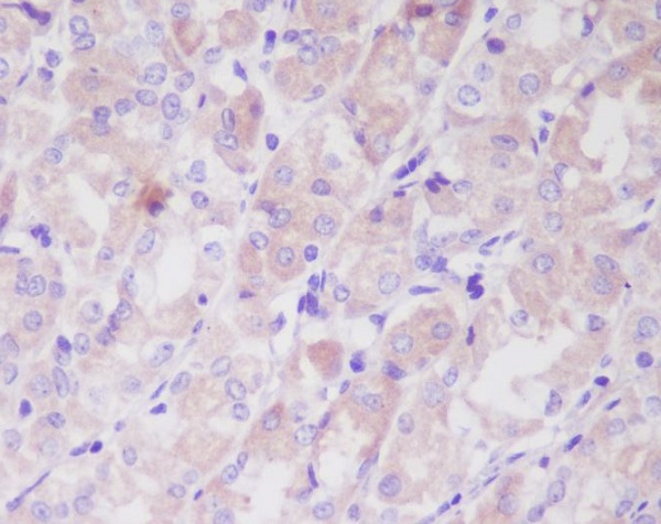 Rabbit Polyclonal Antibody to Integrin Linked ILK