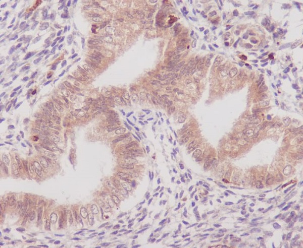 Rabbit Polyclonal Antibody to Cyclooxygenase 1