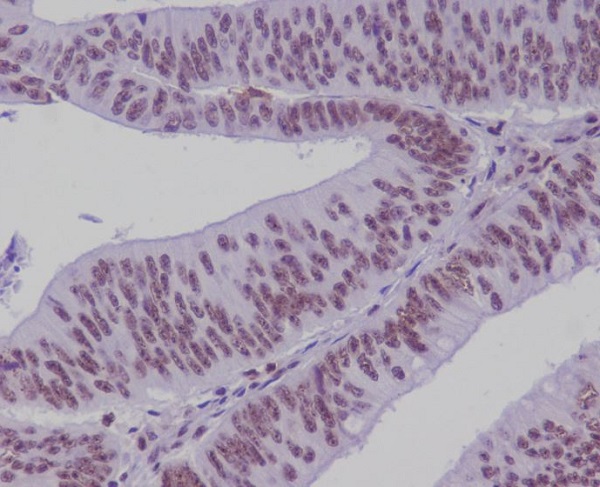 Rabbit Polyclonal Antibody to Transcription Factor 7 Like 2