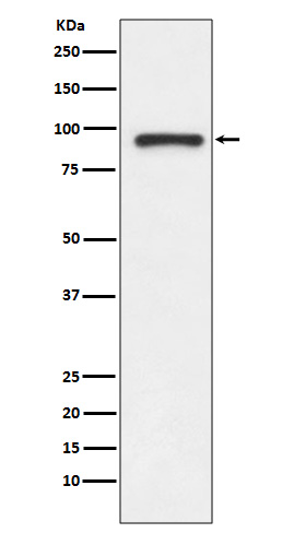 Topoisomerase I