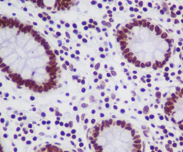 Rabbit Polyclonal Antibody to Topoisomerase I