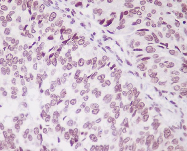 Rabbit Polyclonal Antibody to PARK7/DJ1