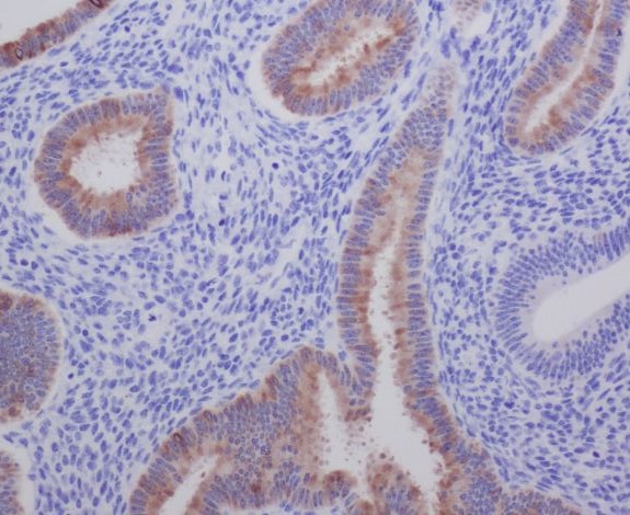 Rabbit Polyclonal Antibody to Anterior Gradient 2