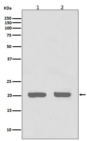 IL-1 Receptor Antagonist Protein