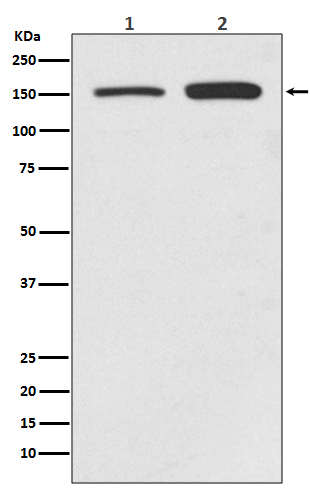 SMC1A