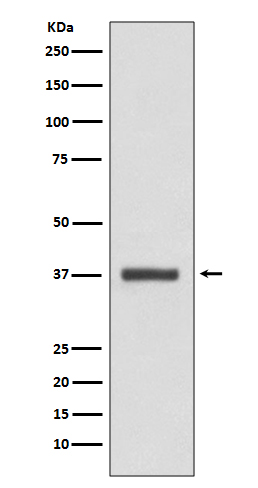 CDK6