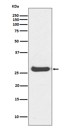 Histone H1.0