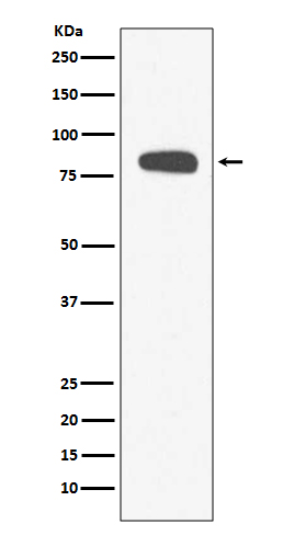 Stromal Interaction Molecule 1