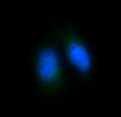 Rabbit Polyclonal Antibody to FOXO4