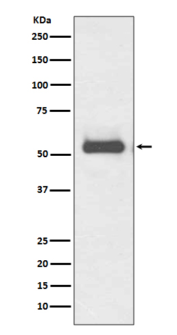 TFG