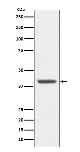 HDAC8