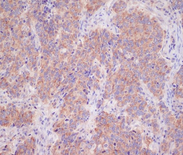 Rabbit Polyclonal Antibody to 14-3-3