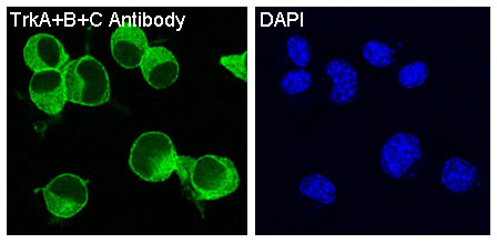 Rabbit Polyclonal Antibody to Trk