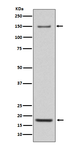 Integrin alpha 5