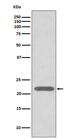Peroxiredoxin 2