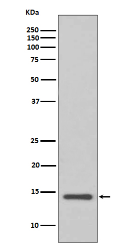 Cystatin C