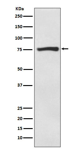 ACSS2