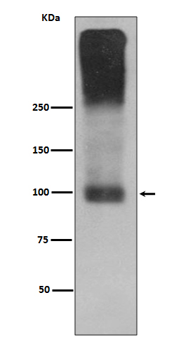 Metabotropic Glutamate Receptor 2
