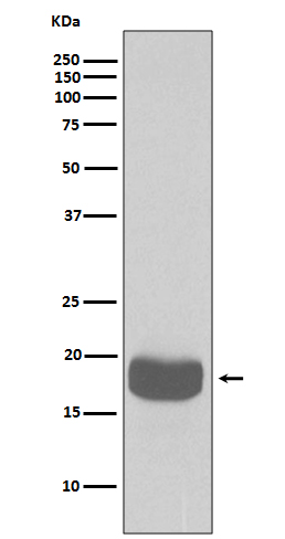 4E BP1