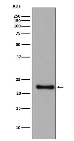 Glutathione Peroxidase 1