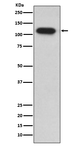 Insulin Degrading Enzyme