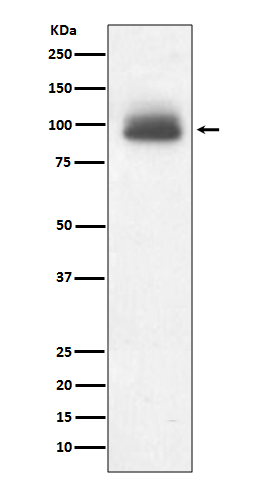 Glucocorticoid Receptor