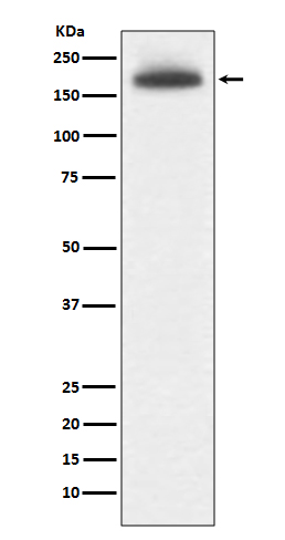 Mannose Receptor