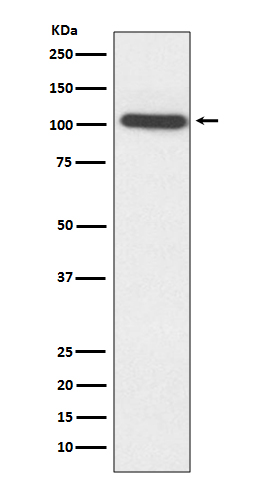 Sarcomeric alpha Actinin