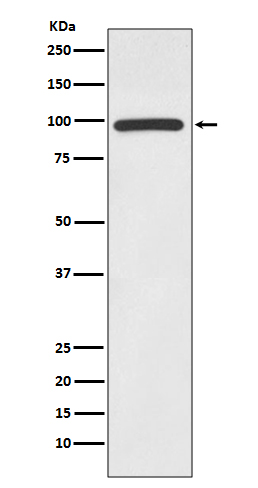 HMGCR