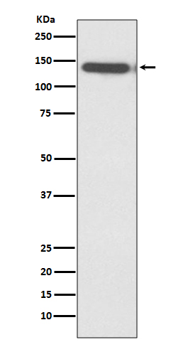 Ctip2