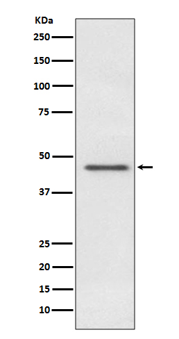 Pyruvate Dehydrogenase E1 alpha