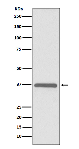 ERCC1