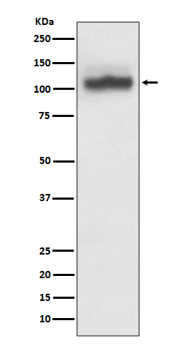 SERCA2 ATPase
