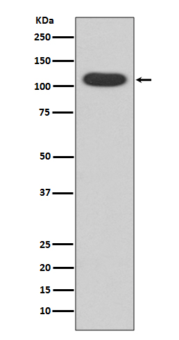 Aryl Hydrocarbon Receptor