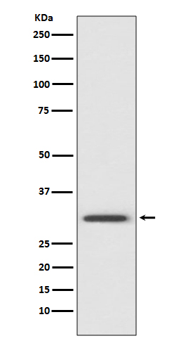 Annexin V