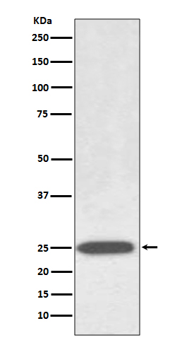 Aquaporin 1