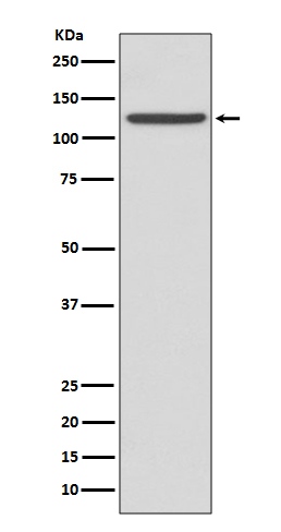 Integrin alpha IIb