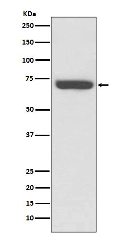 TNF Receptor 2