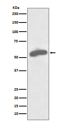 Glucose 6 Phosphate Dehydrogenase