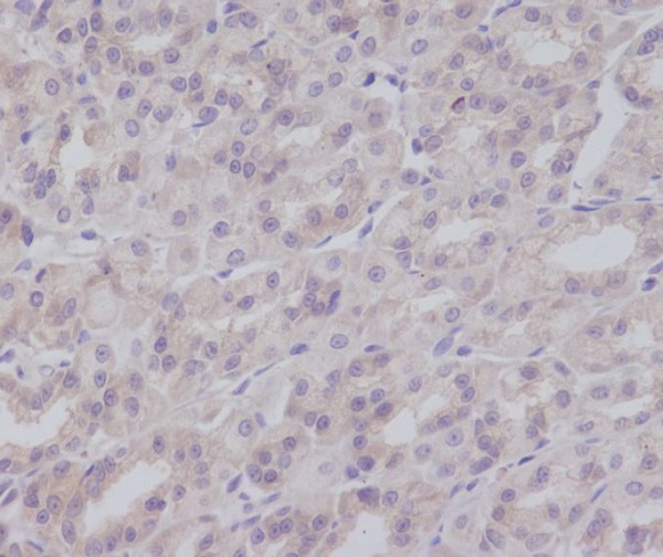 Rabbit Monoclonal Antibody to IKK gamma 