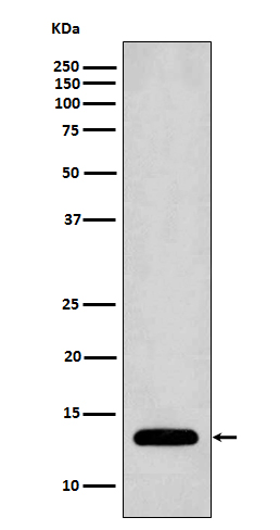 Profilin 1