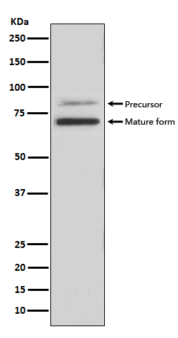 PCSK9