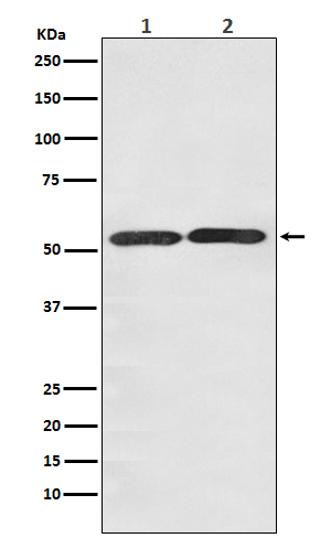 Glucose Transporter GLUT3