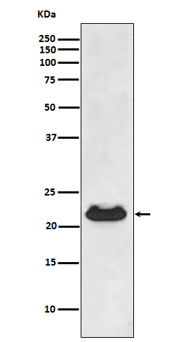 alpha B Crystallin